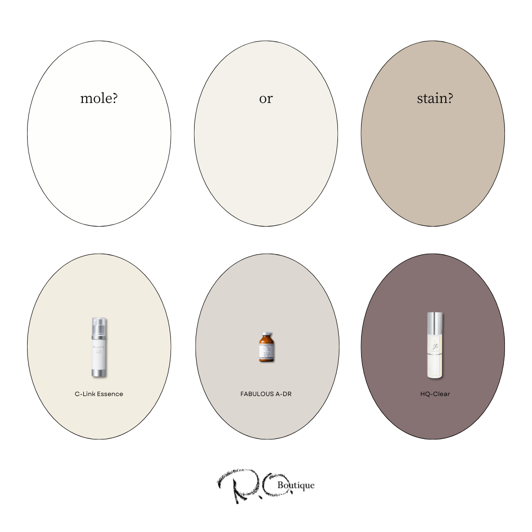 これってシミ??ほくろ?